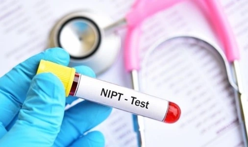 NIPT Test 